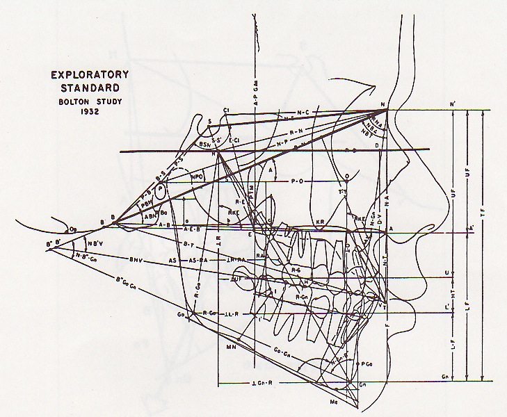 Cephalometric Analysis Cephx 