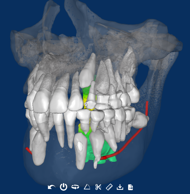 Case Study 3D segmentation